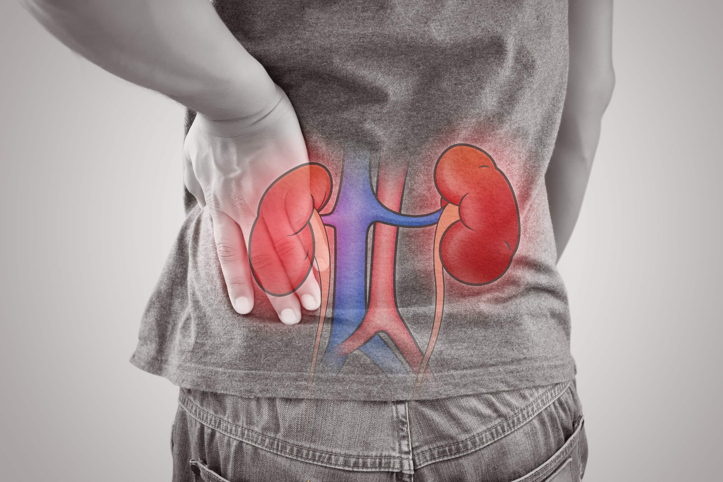 Common Homeopathic Medicines for Kidney Disease