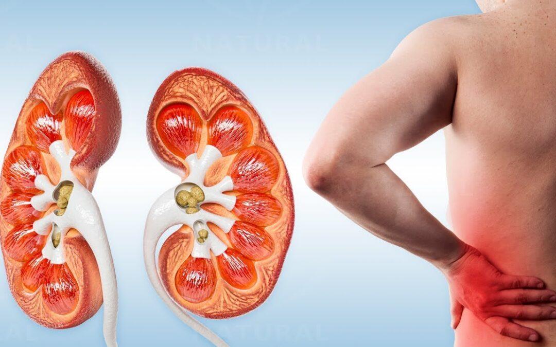 Natural Plan to Reverse Kidney Disease
