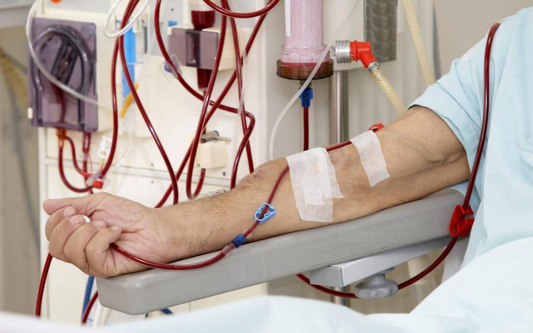 Can Dialysis Be Temporary
