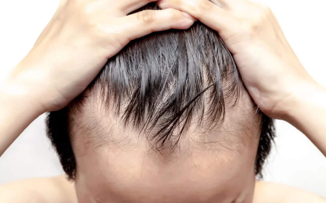 Low Potassium Cause Hair Loss