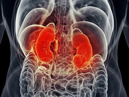 What would cause acute kidney injury