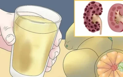 5 Things That You Can Do Today To Stop Kidney From Getting Worse