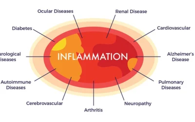 How to Overcome Inflammation in Diabetes?