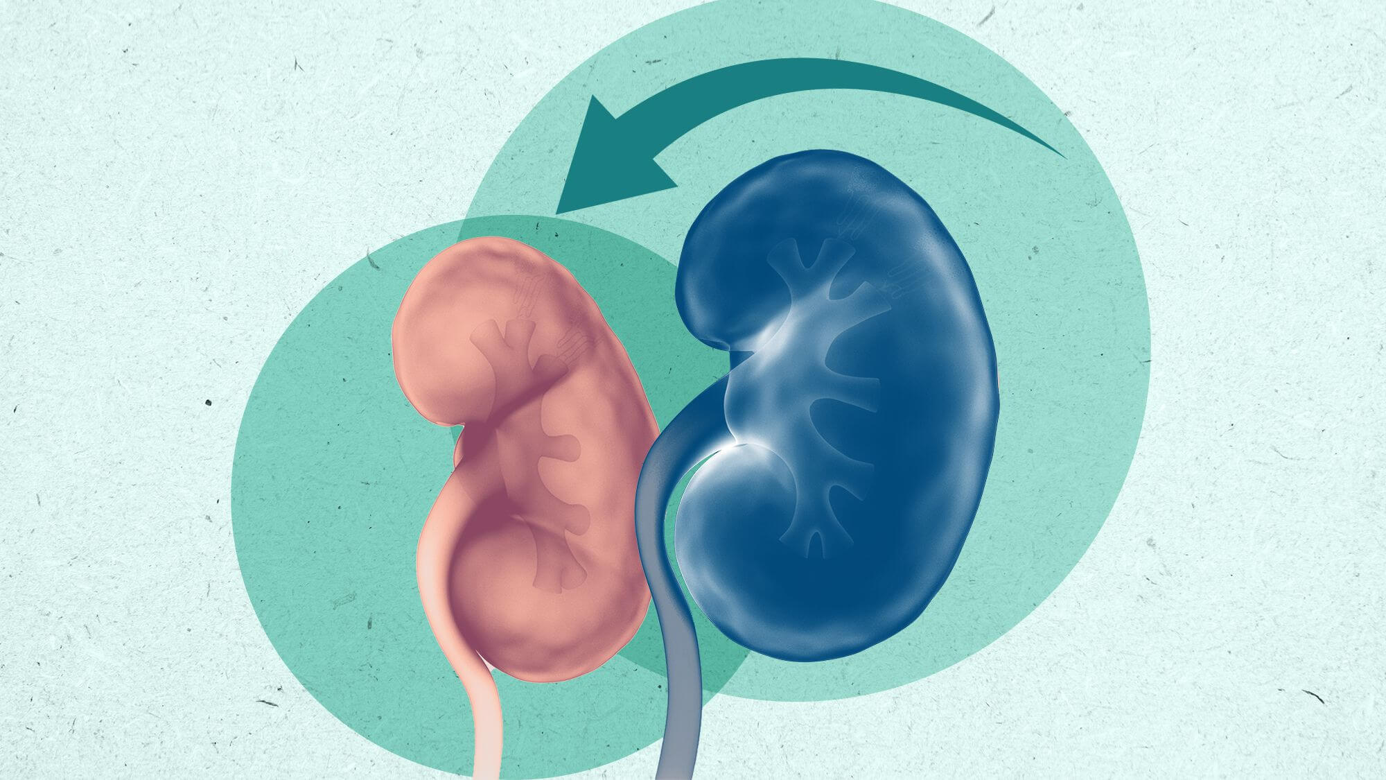 7-ways-to-keep-your-kidneys-healthy-kidney-health-md