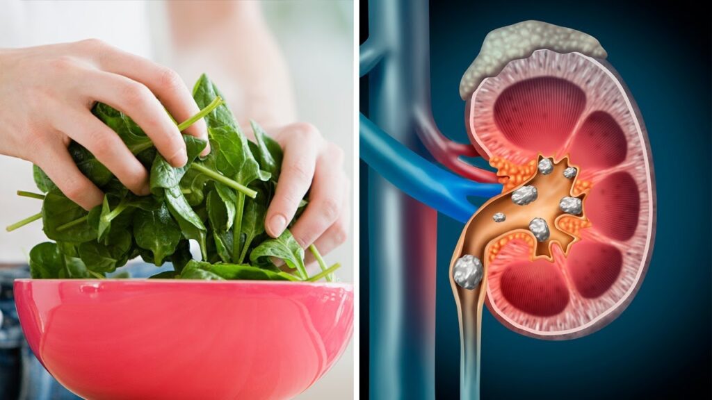 Foods to Limit To Protect Your Kidneys