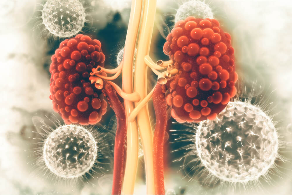 Functional Medicine Labs to Assess Root Cause of Kidney Disease