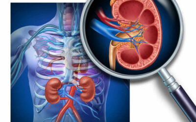 Holistic Kidney Care vs Traditional Nephrology